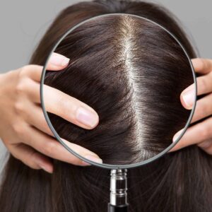 For many women, thinning hair isn’t just a cosmetic concern, it’s a deeply personal issue tied to identity, confidence, and well-being. Historically, hair care has focused on surface-level solutions, rarely addressing the root causes of hair loss. KilgourMD is changing that. Created by a board-certified dermatologist with a personal mission, the brand offers a scientifically-backed, natural system that puts women’s health and confidence at the center of its innovation. From hormonal shifts to environmental stressors, the KilgourMD approach understands that the scalp is where lasting change begins. With advanced formulations, clinical validation, and care-driven values, KilgourMD is bridging the gap between cosmetic beauty and medical science to give women real results—without harsh chemicals or compromises.